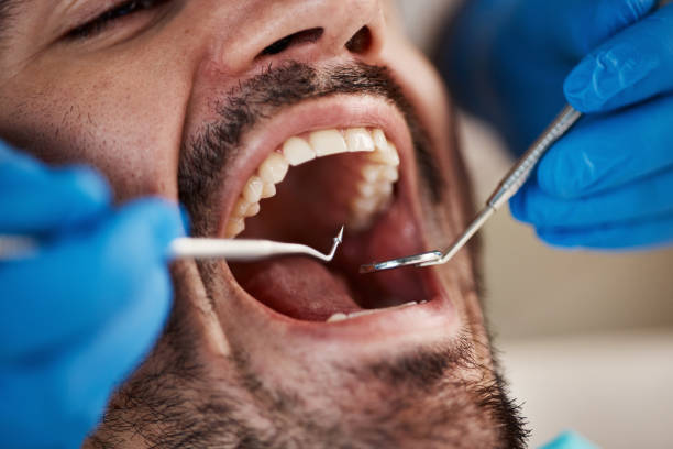 Best Walk-In Emergency Dentist in Nes, IL